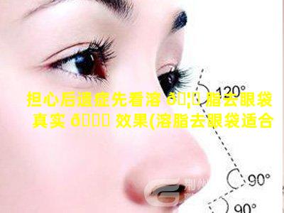 担心后遗症先看溶 🦊 脂去眼袋真实 🍀 效果(溶脂去眼袋适合多大年龄)